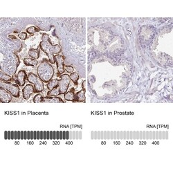 KISS1 Antibody, Novus Biologicals:Antibodies:Primary Antibodies
